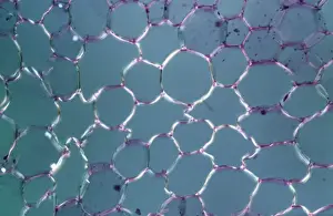 Light Micrograph (LM): tranverse section shows Parenchyma or packing tissue from Cucurbita Stem; Magnification x600 (on 10. 5 cm width print)