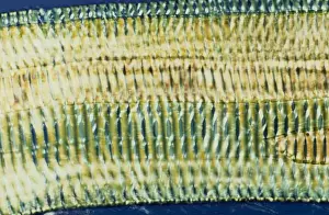 Light Micrograph (LM): Longitudinal section shows Scalariform vessels of Fern; Magnification x1200 (on 10. 5 cm width print)