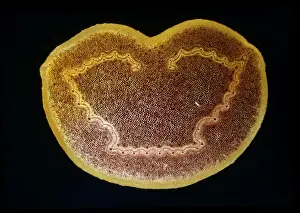 Light Micrograph (LM): A transverse section of a stem of a Tree Fern (Dicksonia antractica); Magnification x9 (on 10. 5 cm width print)