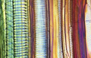 Light Micrograph (LM): Longitudinal section of old sunflower stem(Helianthus sp. ) showing spiral chloroplasts; Magnification x1200 (on 10. 5 cm width print)