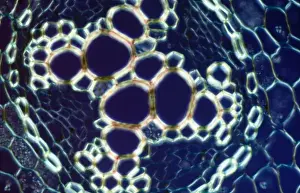 Light Micrograph (LM): transverse section of root of Ranunculus repens (Creeping Buttercup)