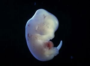 Light Micrograph of Rat Embryo - at 15.5 days