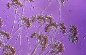 Light Micrograph showing fruiting bodies (conidiophores)