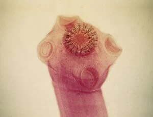Light Micrograph: Tapeworm