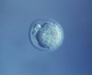 Microscopic Gallery: Mouse Embryo at Single Cell Stage and Polar Body