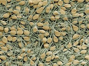 Sperm Collection: Picture No. 10873686