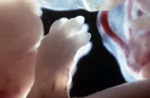 Embryos Prints: Picture No. 10875797