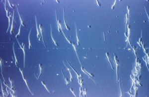 Sperm Collection: Picture No. 10875800