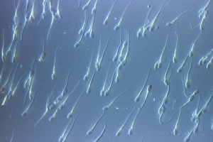 Sperm Collection: Picture No. 10875801