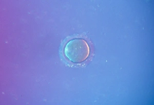 Sperm Collection: Picture No. 10875803