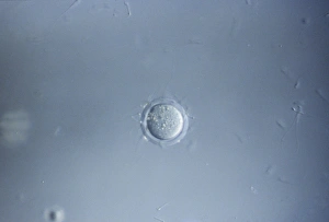 Sperm Collection: Picture No. 10875805