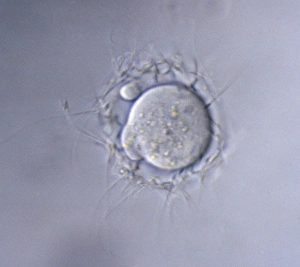 Sperm Collection: Picture No. 10875806