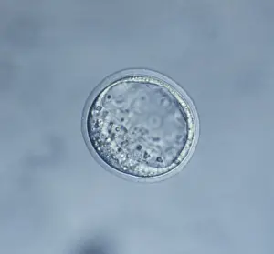 Embryos Prints: Picture No. 10875811