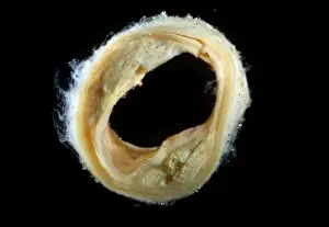 Disease Prints: Picture No. 10875836