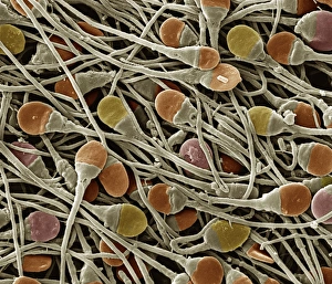 Sperm Collection: Picture No. 10876990