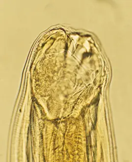 Disease Prints: Picture No. 11675484