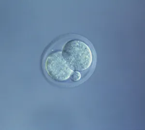 Sperm Collection: Picture No. 11675526