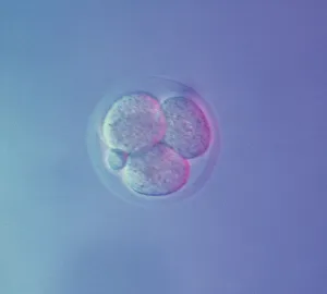 Sperm Collection: Picture No. 11675527