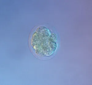 Sperm Collection: Picture No. 11675528