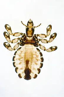 Louse Prints: Pig Louse - x5 magnification