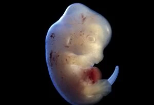 Embryonic Gallery: Rat Embryo at 15.5 days, no sac, no placenta