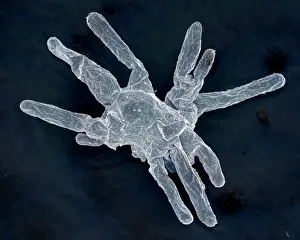 Scanning Electron Micrograph (SEM): Amoeba; Magnification x 850 (A4 size: 29. 7 cm width)