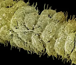 Scanning Electron Micrograph (SEM): close up of a tentacles (cnida) of a Hydra - Magnification unknown
