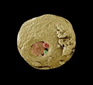 Cell Gallery: Scanning Electron Micrograph (SEM): Early human