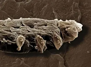 Scanning Electron Micrograph (SEM): Follicle Mite - Magnification x 3800 (if print A4 size: 29. 7 cm wide)