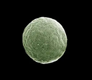 Scanning Electron micrograph (SEM): Grass Pollen grains; Magnification x 3000 (if printed 10. 5 cm wide)