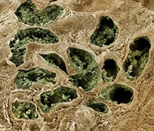 Cells Gallery: Scanning Electron Micrograph (SEM): Human testis