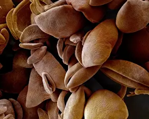 Scanning Electron Micrograph (SEM): Lily pollen; Magnification x 850 (A4 size: 29. 7 cm width)