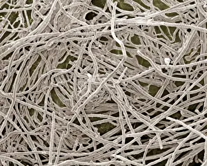 Scanning Electron Micrograph (SEM): Mycorrhiza; Magnification x 1, 500 (A4 size: 29. 7 cm width)