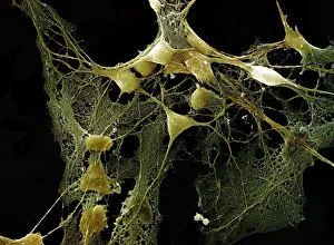 Scanning Electron Micrograph (SEM): Nerve cells grown in a culture