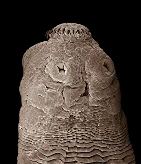 Tapeworm CHI0860